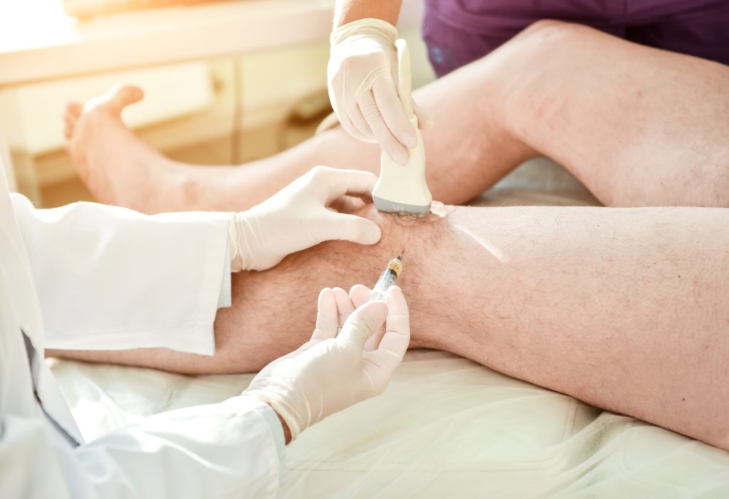 Ultrasound Guided Platelet Rich Plasma Injection Knee