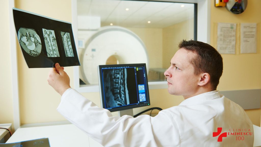 RMN Prostata 1024x576