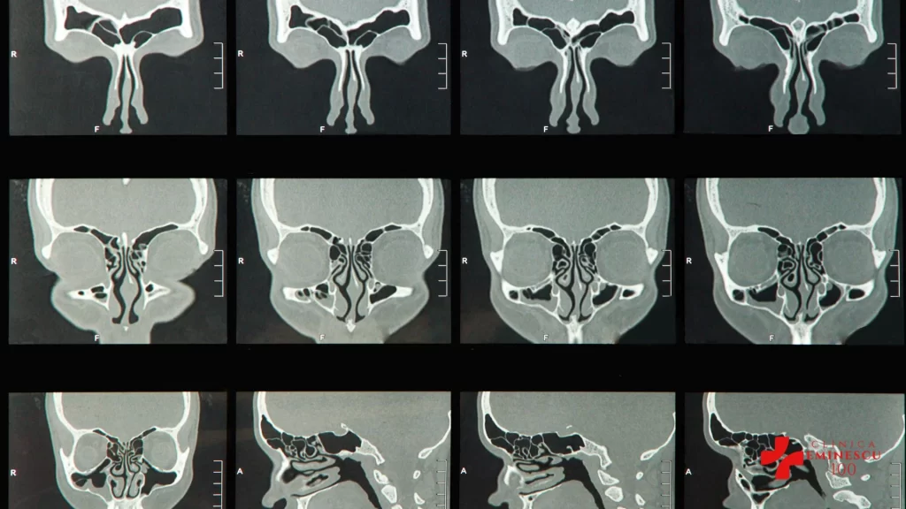 RMN Sinusuri Eminescu 100 1024x576