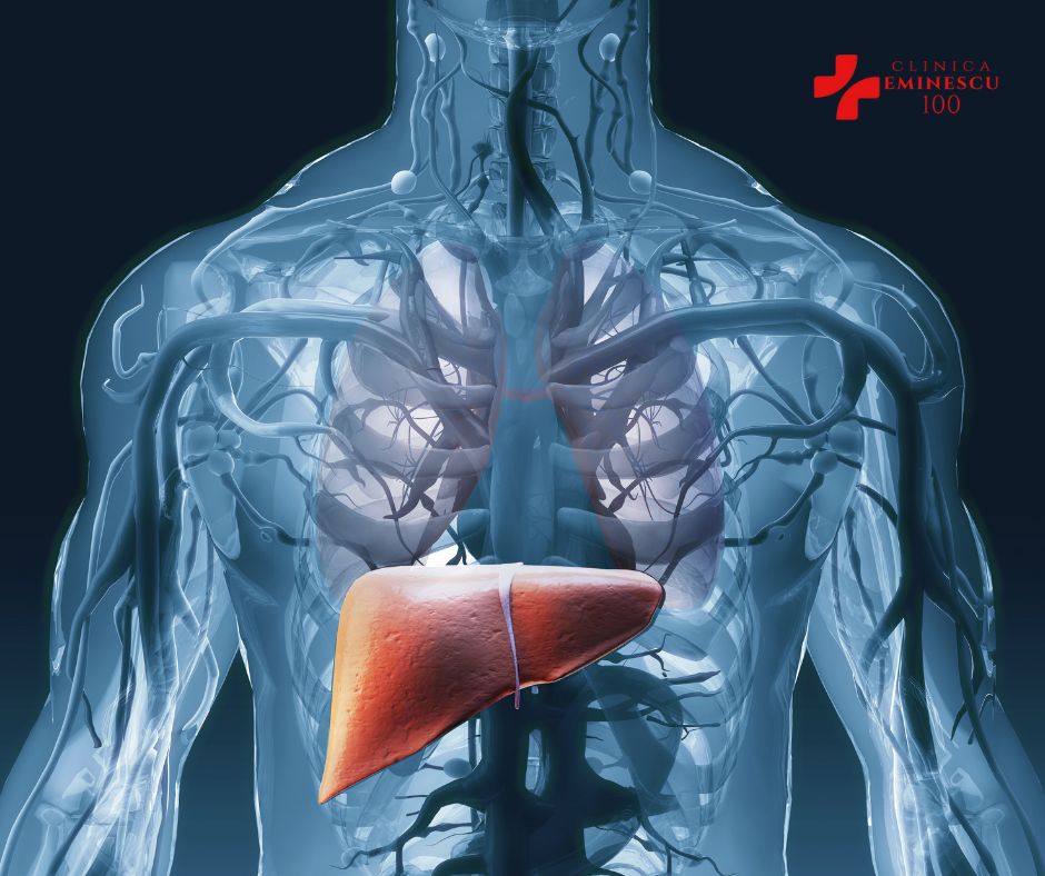 Imagistica In Cancerul La Ficat