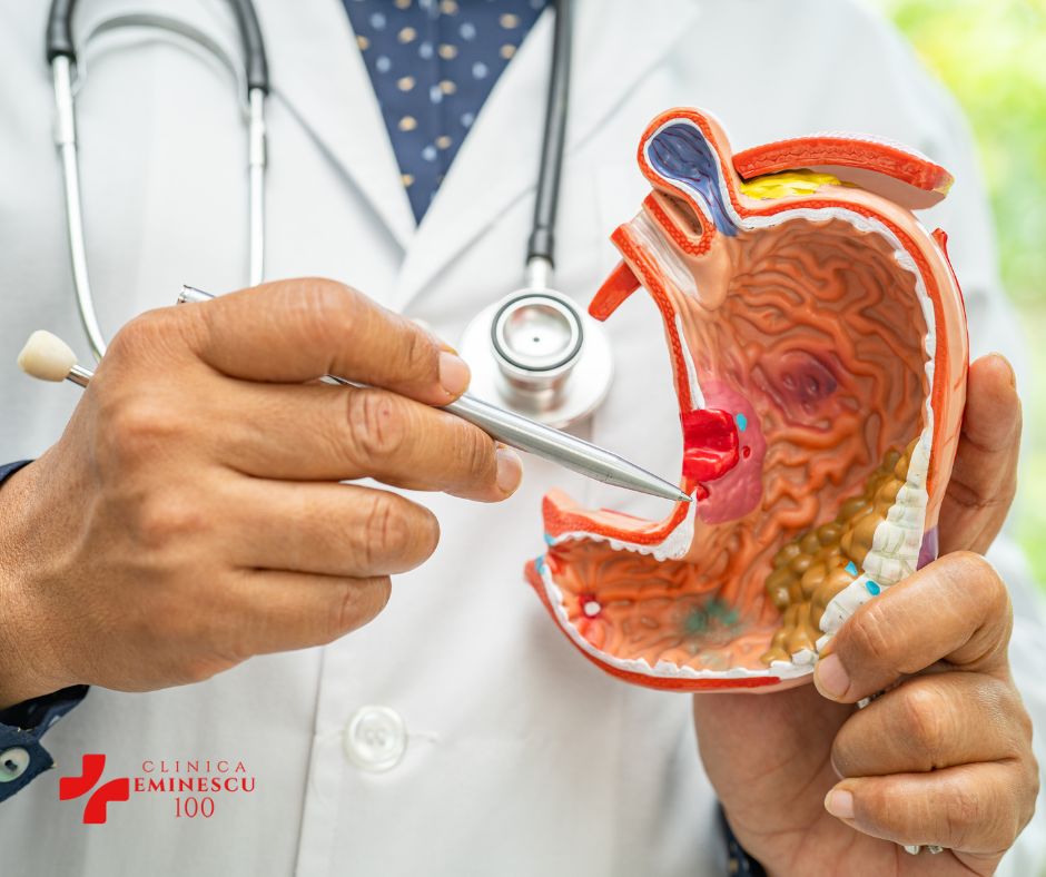 Imagistica In Cancerul La Stomac