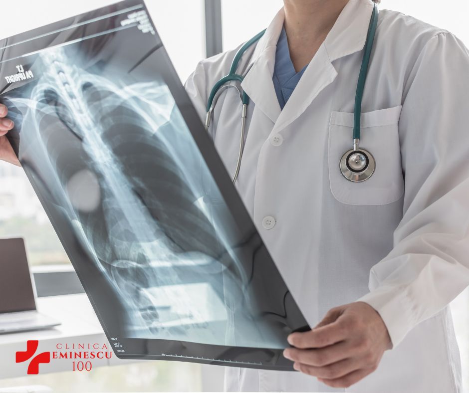 Imagistica In Cancerul Osos