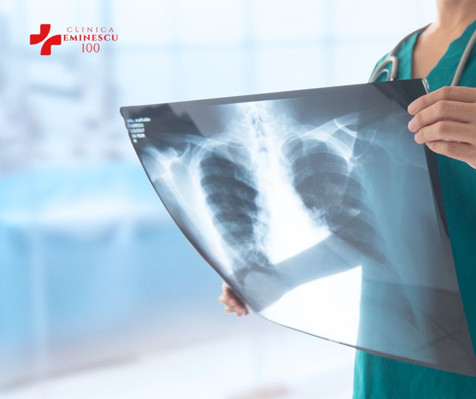 Radiatii Medicale Eminescu 100
